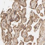 EPS8 Antibody in Immunohistochemistry (Paraffin) (IHC (P))