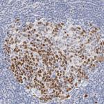 MCM7 Antibody in Immunohistochemistry (Paraffin) (IHC (P))