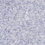 MCM7 Antibody in Immunohistochemistry (Paraffin) (IHC (P))