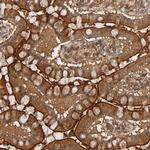 RSK4 Antibody in Immunohistochemistry (Paraffin) (IHC (P))