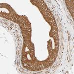 BAP31 Antibody in Immunohistochemistry (Paraffin) (IHC (P))