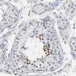 SOX6 Antibody in Immunohistochemistry (Paraffin) (IHC (P))