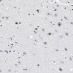 SOX6 Antibody in Immunohistochemistry (Paraffin) (IHC (P))