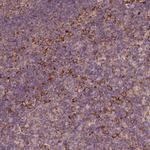 G3BP1 Antibody in Immunohistochemistry (Paraffin) (IHC (P))