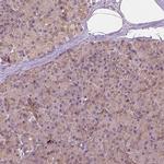 G3BP1 Antibody in Immunohistochemistry (Paraffin) (IHC (P))