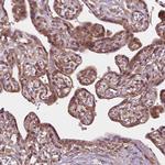 G3BP1 Antibody in Immunohistochemistry (Paraffin) (IHC (P))