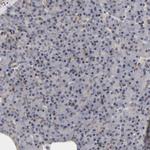 Laminin beta-1 Antibody in Immunohistochemistry (Paraffin) (IHC (P))