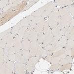 Laminin beta-1 Antibody in Immunohistochemistry (Paraffin) (IHC (P))