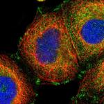 GIT1 Antibody in Immunocytochemistry (ICC/IF)