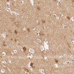 GIT1 Antibody in Immunohistochemistry (Paraffin) (IHC (P))