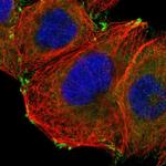 GIT1 Antibody in Immunocytochemistry (ICC/IF)