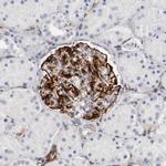 GIT1 Antibody in Immunohistochemistry (Paraffin) (IHC (P))