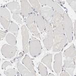 GIT1 Antibody in Immunohistochemistry (Paraffin) (IHC (P))