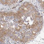 GIT1 Antibody in Immunohistochemistry (Paraffin) (IHC (P))