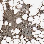 S100A9 Antibody in Immunohistochemistry (Paraffin) (IHC (P))