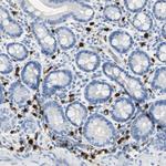 S100A9 Antibody in Immunohistochemistry (Paraffin) (IHC (P))