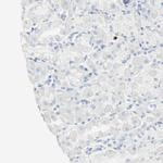 S100A9 Antibody in Immunohistochemistry (Paraffin) (IHC (P))