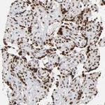 TRIM33 Antibody in Immunohistochemistry (Paraffin) (IHC (P))