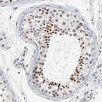 TRIM33 Antibody in Immunohistochemistry (Paraffin) (IHC (P))