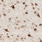 PSAP Antibody in Immunohistochemistry (Paraffin) (IHC (P))