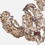 PSAP Antibody in Immunohistochemistry (Paraffin) (IHC (P))