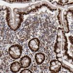 HNF4A Antibody in Immunohistochemistry (Paraffin) (IHC (P))