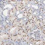 HNF4A Antibody in Immunohistochemistry (Paraffin) (IHC (P))