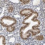 Progesterone Receptor Antibody in Immunohistochemistry (Paraffin) (IHC (P))