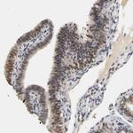 Progesterone Receptor Antibody in Immunohistochemistry (Paraffin) (IHC (P))