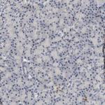 Progesterone Receptor Antibody in Immunohistochemistry (Paraffin) (IHC (P))