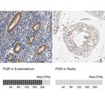 Progesterone Receptor Antibody