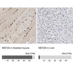 MEF2D Antibody