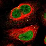 MEF2D Antibody in Immunocytochemistry (ICC/IF)