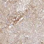 Tenascin C Antibody in Immunohistochemistry (Paraffin) (IHC (P))