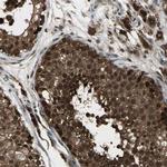 JAB1 Antibody in Immunohistochemistry (Paraffin) (IHC (P))