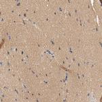 HGS Antibody in Immunohistochemistry (Paraffin) (IHC (P))