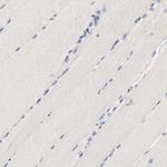 HGS Antibody in Immunohistochemistry (Paraffin) (IHC (P))