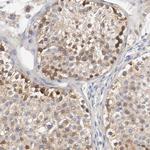 HGS Antibody in Immunohistochemistry (Paraffin) (IHC (P))