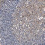 HGS Antibody in Immunohistochemistry (Paraffin) (IHC (P))