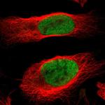 MCM4 Antibody in Immunocytochemistry (ICC/IF)