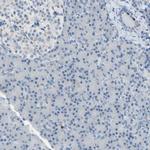 MCM4 Antibody in Immunohistochemistry (Paraffin) (IHC (P))