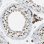 MCM4 Antibody in Immunohistochemistry (Paraffin) (IHC (P))