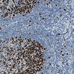 MCM4 Antibody in Immunohistochemistry (Paraffin) (IHC (P))