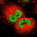 Cyclin T1 Antibody in Immunocytochemistry (ICC/IF)