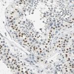 Cyclin T1 Antibody in Immunohistochemistry (Paraffin) (IHC (P))