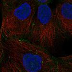 Desmoglein 2 Antibody in Immunocytochemistry (ICC/IF)