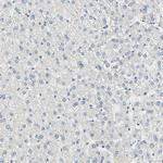 Desmoglein 2 Antibody in Immunohistochemistry (Paraffin) (IHC (P))