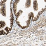 Desmoglein 2 Antibody in Immunohistochemistry (Paraffin) (IHC (P))