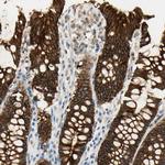 Desmoglein 2 Antibody in Immunohistochemistry (Paraffin) (IHC (P))