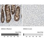 Desmoglein 2 Antibody